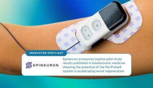 FDA-approved PeriPulse device. Epineuron announces topline pilot study results published in bioelectronic medicine showing the potential of the PeriPulse® system in accelerating nerve regeneration.