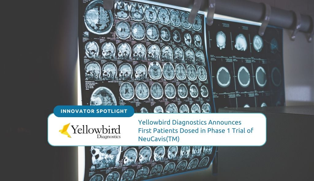 Yellowbird Diagnostics Inc. announced the successful dosing and imaging of the first participants in its Phase I clinical trial of NeuCaVis.