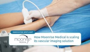 Learn how Moonrise Medical is leveraging the CAMEDA program to scale its AI vascular imaging platform and accelerate its path to market.